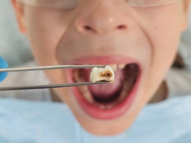Best Pediatric Emergency Dentist in Hawley, MN